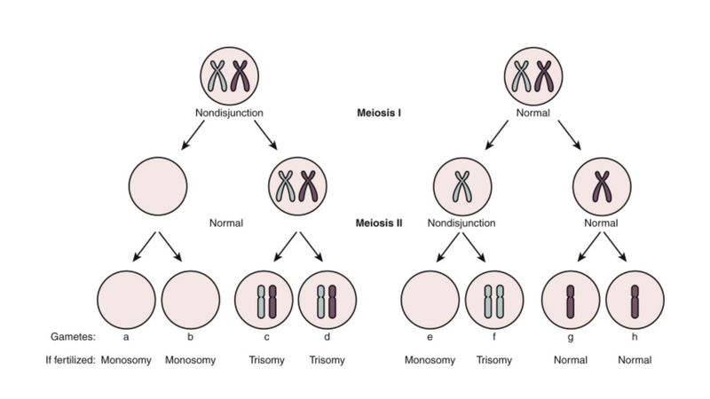 Hội chứng di truyền UPD: Hiểu rõ về tình trạng rối loạn nhiễm sắc thể 4