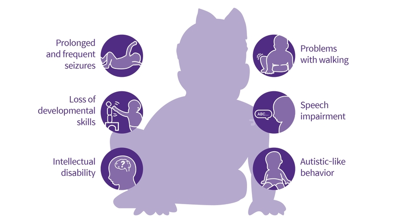 Hội chứng Dravet là gì? Cách chẩn đoán hội chứng Dravet ở trẻ 1