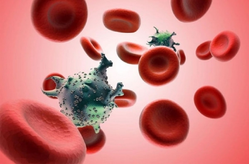 Hội chứng Duncan là gì? Cách chẩn đoán và điều trị hội chứng Duncan 4