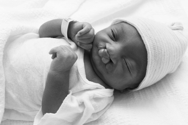 Hội chứng Edwards: Nguyên nhân, triệu chứng, chẩn đoán và điều trị 3