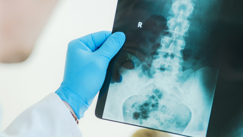 Hội chứng Fraser là gì? Cách điều trị hội chứng Fraser 2