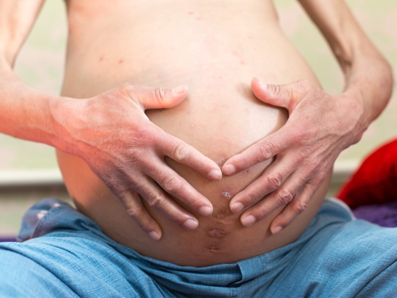 Hội chứng gan thận: Nguyên nhân, triệu chứng và phương pháp điều trị 3