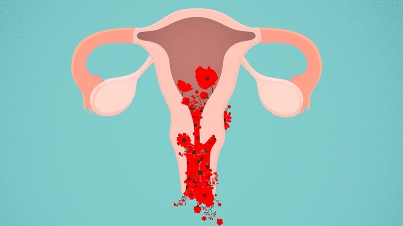 Hội chứng hậu Covid rong kinh điều trị bằng cách nào 2