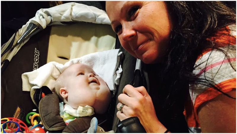 Hội chứng Hygroma Kystique là gì? 2