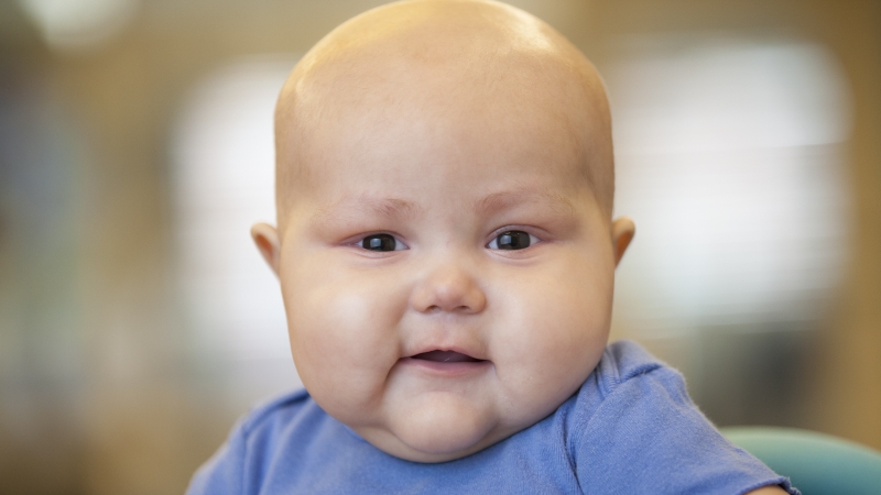 Hội chứng Jacobsen là tình trạng mất một phần vật chất di truyền trên nhánh dài (q) của nhiễm sắc thể số 11