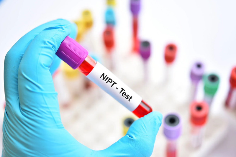 Xét nghiệm NIPT giúp phát hiện sớm những trẻ mắc hội chứng Jacobsen