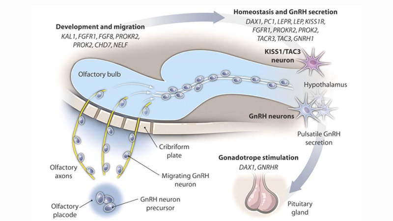 Hội chứng Kallmann: Nguyên nhân, triệu chứng và điều trị 3