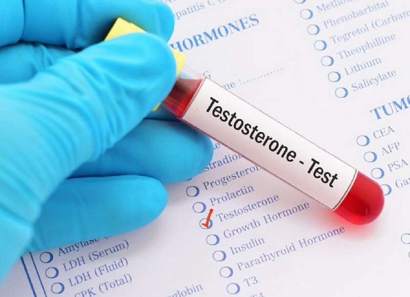 Hội chứng không nhạy cảm androgen là gì 2