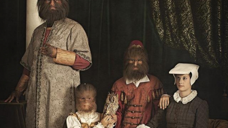 Hội chứng người sói và những điều cần biết 2.jpeg