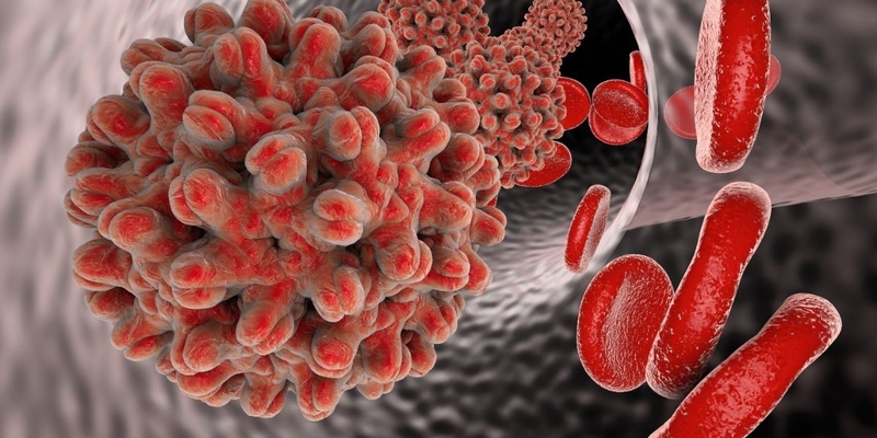 Hội chứng nhiễm trùng và những vấn đề liên quan bạn nên biết 3