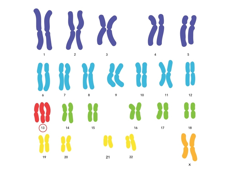 Hội chứng Patau: Nguyên nhân, triệu chứng và các biện pháp chẩn đoán 1