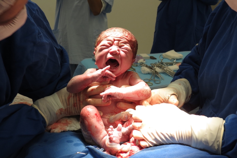 Hội chứng phổi ướt ở trẻ sơ sinh là bệnh gì? Có nguy hiểm không 1