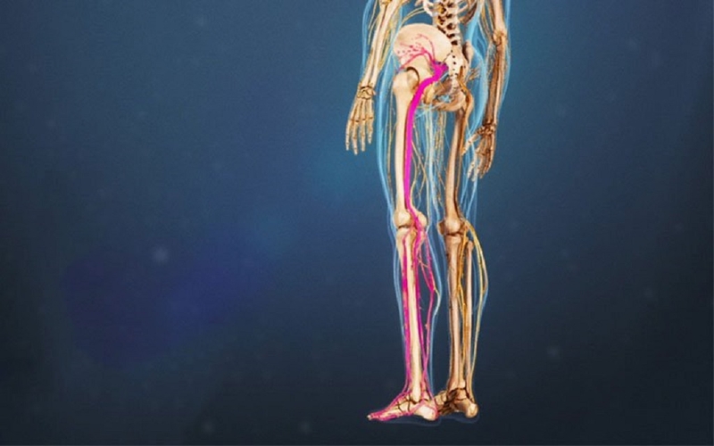 Hội chứng Piriformis: Nguyên nhân, dấu hiệu nhận biết và cách điều trị 1
