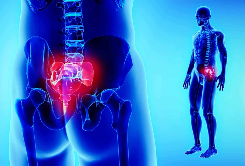 Hội chứng Piriformis: Nguyên nhân, dấu hiệu nhận biết và cách điều trị 4