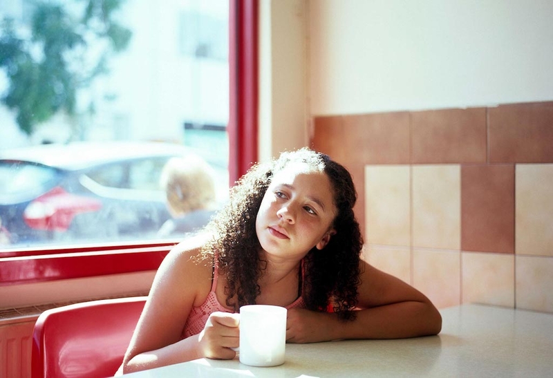 Hội chứng Prader-willi: Cách điều trị và chăm sóc bệnh nhân 4