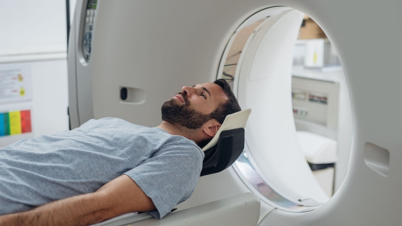 Hội chứng quên tạm thời: Nguyên nhân, triệu chứng 3