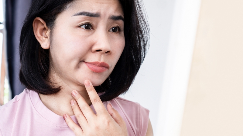 Dấu hiệu nhận biết hội chứng Ramsay Hunt là gì?