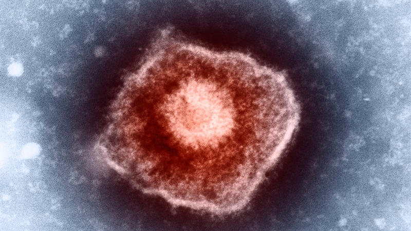 Bắt nguồn từ sự tấn công của virus varicella zoster