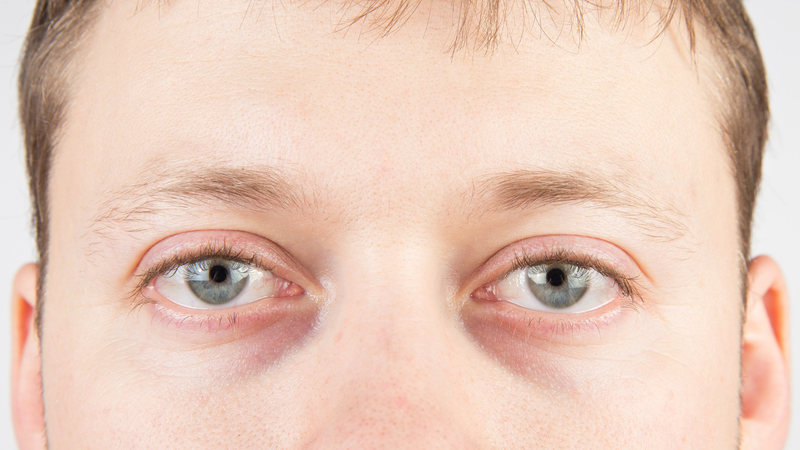 hoi-chung-sjogren-la-gi-dau-hieu-nhan-biet-nhu-the-nao (2).png