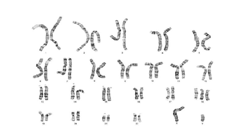 Hội chứng Smith-Magenis là gì? Nguyên nhân và cách điều trị 2