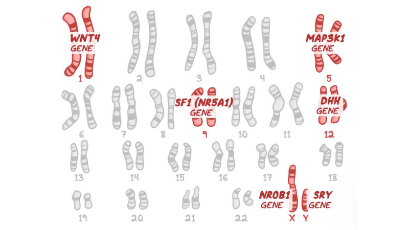 Hội chứng Swyer: Nguyên nhân, triệu chứng, chẩn đoán và điều trị 5