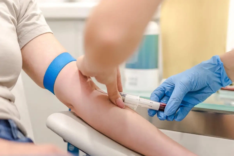 Hội chứng tan máu tăng ure máu (HUS)nguy hiểm thế nào 3