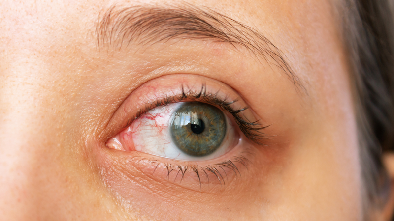 Hội chứng thị giác màn hình là gì? Phương pháp điều trị hội chứng thị giác màn hình 2