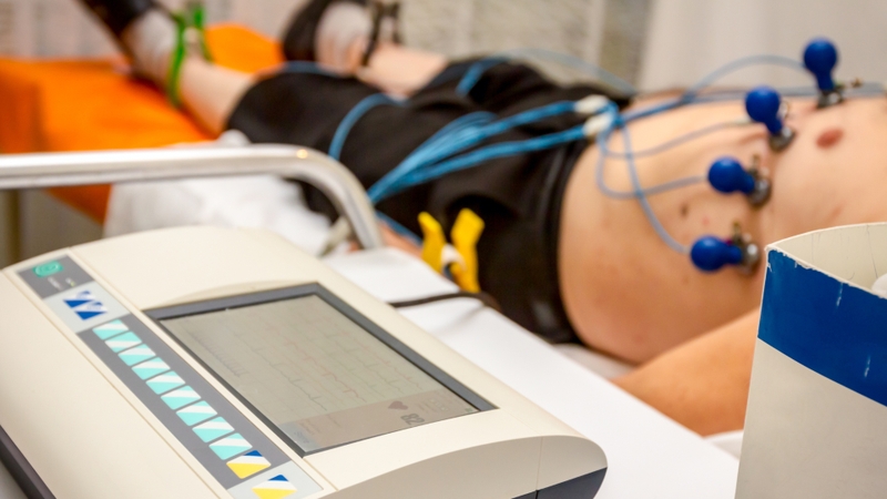 ECG thường cho thấy ST chênh lên ở các chuyển đạo trước tim, sóng T âm sâu và/hoặc kéo dài khoảng QTc