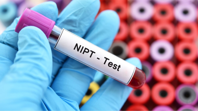 Xét nghiệm NIPT là phương pháp sàng lọc trước sinh giúp phát hiện sớm những bất thường ở trẻ