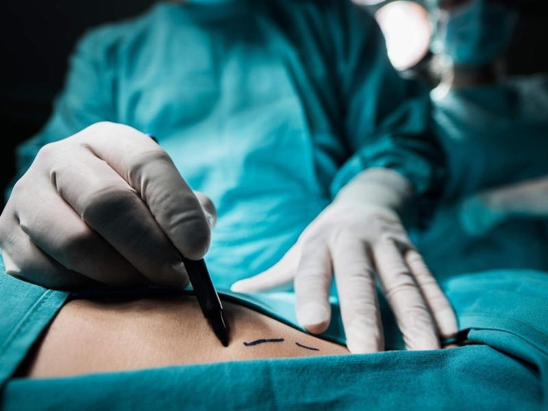 Hội chứng vàng da tắc mật là gì? Nguyên nhân, triệu chứng, chẩn đoán và cách điều trị 4