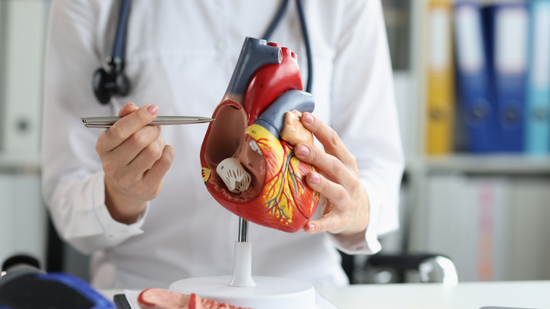 Hội chứng vành cấp là gì? Nguyên nhân và cách điều trị hội chứng vành cấp 3