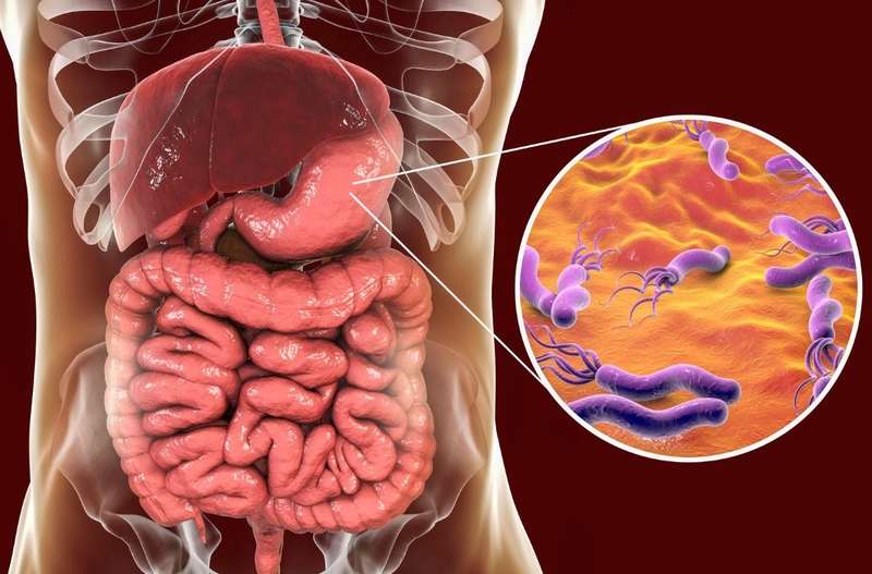 Hội chứng viêm dạ dày không phổ biến gồm những bệnh nào 3