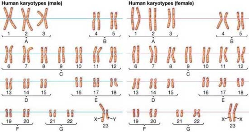 Hội chứng XYY là gì? Một số điều cần biết về hội chứng XYY ở nam giới 1