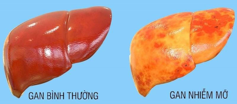 Hội chứng Yoyo có gây hại cho sức khỏe không? Cách thoát khỏi hội chứng Yoyo 3