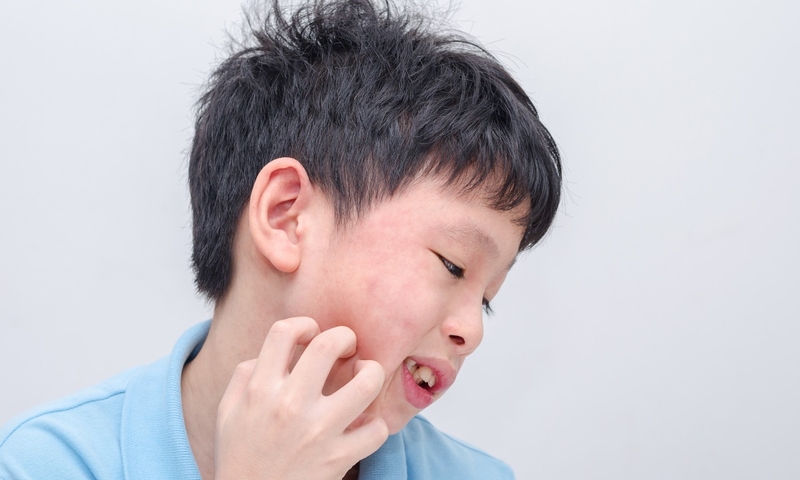 Hỏi đáp: Chương trình tiêm chủng mở rộng có mũi quai bị không? 1