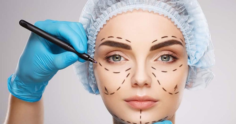 Hỏi đáp làm đẹp: Cắt mí bao lâu thì hết sẹo?2