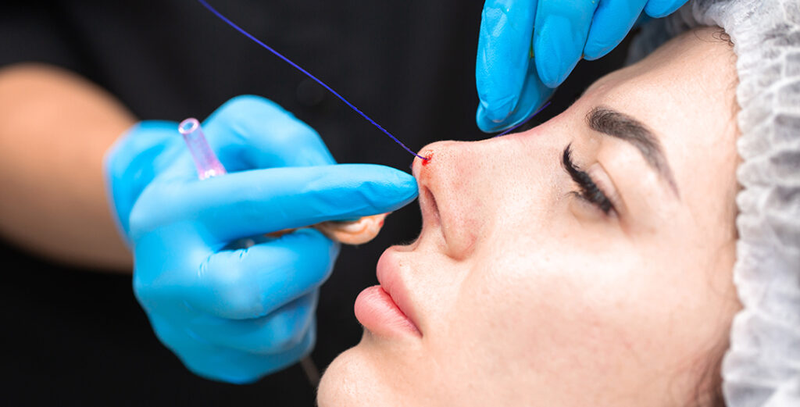 Hỏi đáp: Nâng mũi chỉ có an toàn không? 2