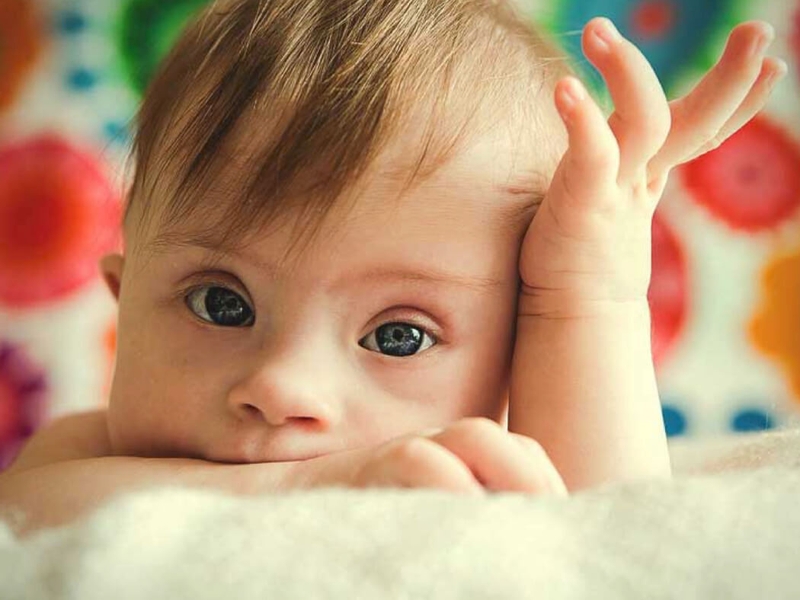 [Hỏi đáp] Siêu âm 4D có phát hiện bệnh Down không 3