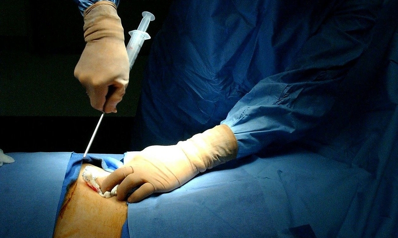 Hỏi đáp: Suy tủy có phải ung thư máu không? 03