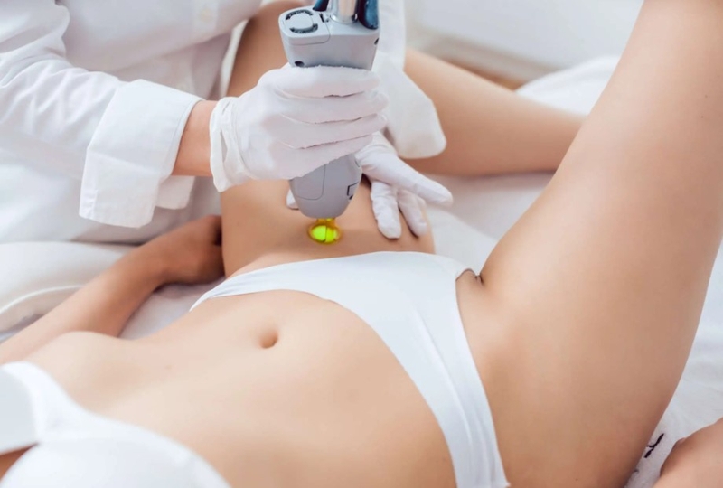 Hỏi đáp: Triệt lông vùng bikini giá bao nhiêu? 1