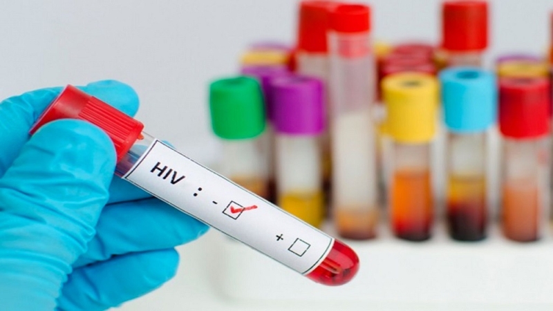 Xét nghiệm HIV được thực hiện để tìm&nbsp;kháng nguyên hoặc kháng thể đối với virus HIV