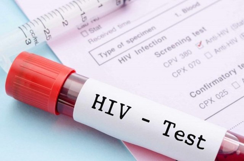 Xét nghiệm HIV thường rất chính xác