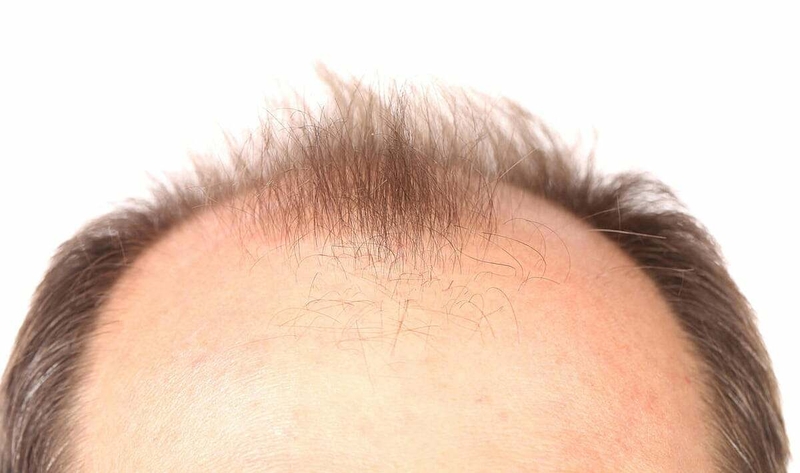 Hút thuốc lá gây lão hóa sớm 3