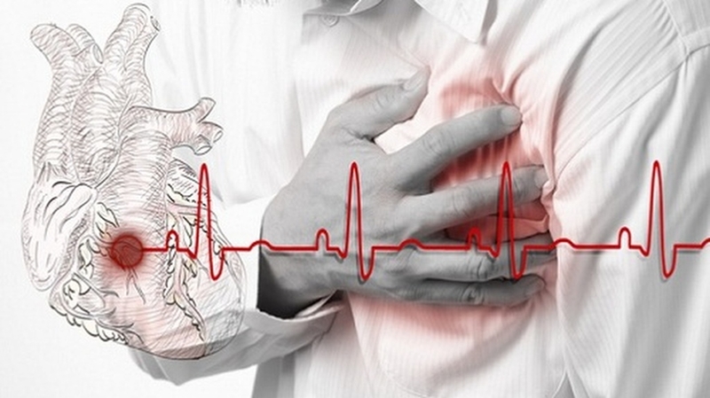 Hồi hộp đánh trống ngực: Nguyên nhân, triệu chứng và cách điều trị 2