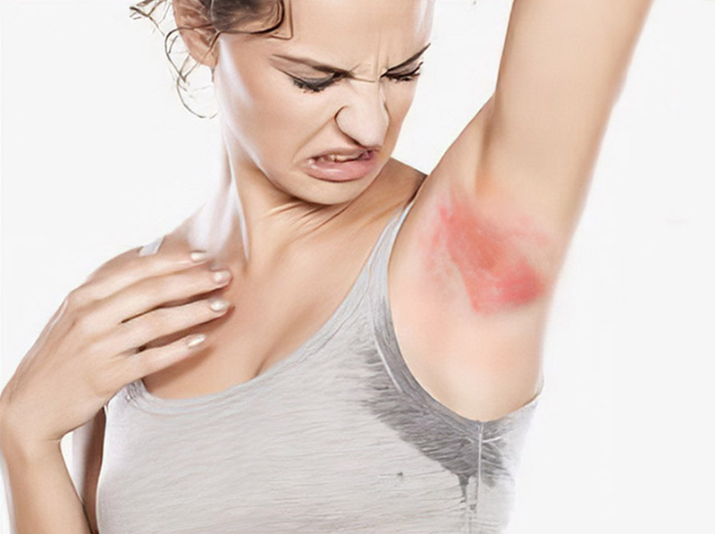Hôi nách gây ngứa, khó chịu làm sao chữa khỏi? 1