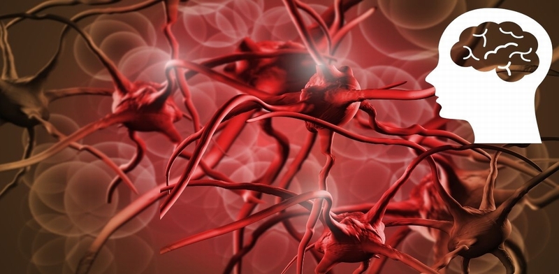 Hỏi và đáp: "Thiếu máu não có nguy hiểm không?" 2