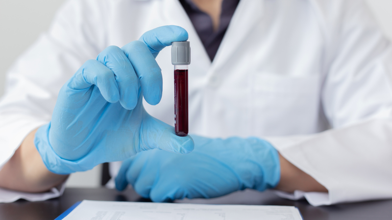 Hồng cầu dạng hình bia thường không nguy hiểm nhưng cần được theo dõi