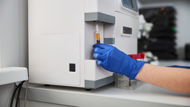 Chỉ số hồng cầu lưới thường được tính tự động bằng máy phân tích huyết học