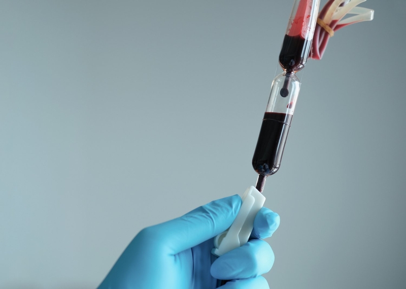 Hồng cầu nghèo bạch cầu là gì? Khi nào cần sử dụng hồng cầu nghèo bạch cầu? 4