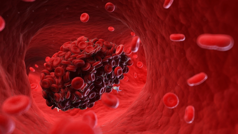 Hồng cầu trong nước tiểu bao nhiêu là bình thường? Nguyên nhân phổ biến gây hồng cầu trong nước tiểu 1